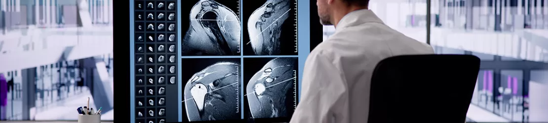 Medic radiolog examineaza imagini RMN umar