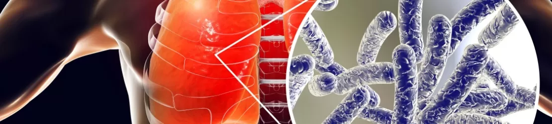 Bacterie Legionella pneumophila in plamanii umani, ilustratie 3D