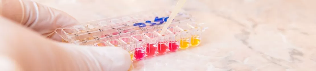 Cercetator stiintific in laborator folosind un pipet pentru testarea probelor bacteriologice