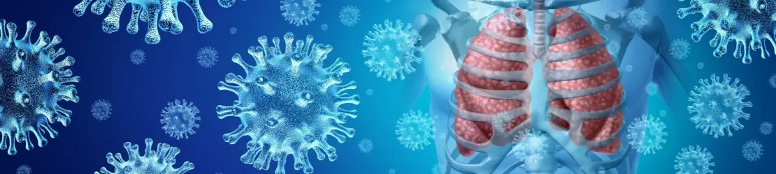 Ilustratie a raspandirii unei pneumonii virale in sistemul respirator