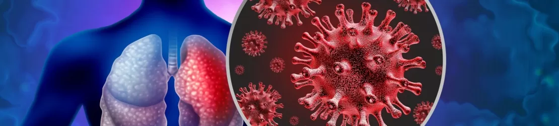 Ilustratie a unui focar de pneumonie cauzat de un virus patogen, infectie pulmonara