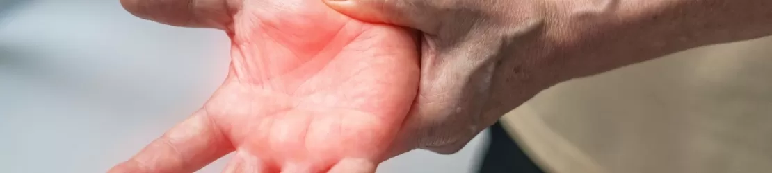 Pacient cu sindrom guillain-barre care sufera de durere neuropatica la maini