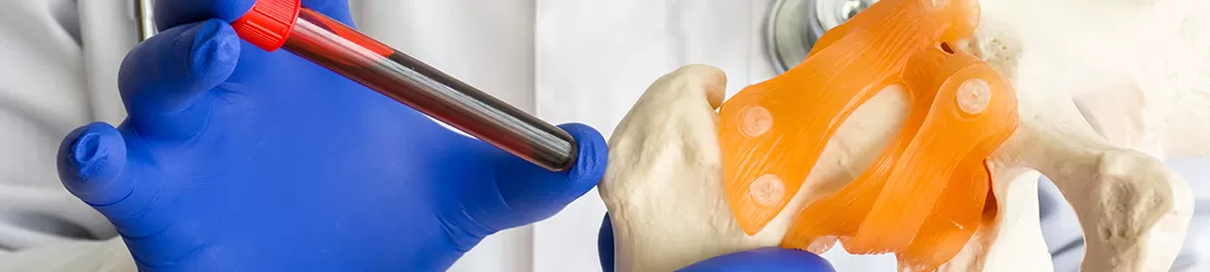 Laborator medical cu teste de diagnostic pentru oase si articulatii, evidentiind analiza si investigatiile clinice amanuntite