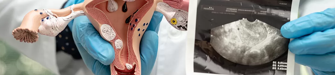 Medic tine un model de anatomie al uterului si ovarelor, explicand structura si functiile aparatului reproducator feminin