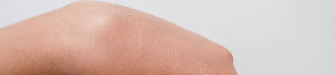 Chist ganglionic pe mana unei femei, izolat pe fundal alb, prezentand umflatura benigna la nivelul incheieturii