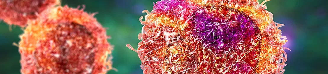 Ilustratie 3d stiintifica cu celule canceroase maligne, evidentiind forma si comportamentul acestora in contextul dezvoltarii tumorilor