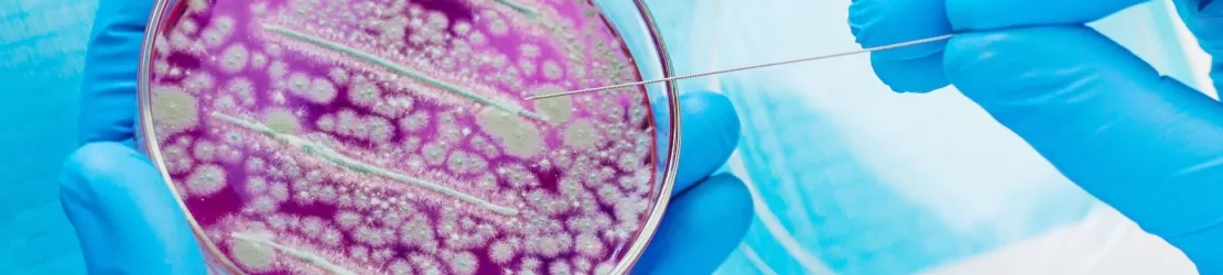 Cercetator examinand bacterii in placi Petri intr-un laborator, evidentiind studiul microbian si procedurile stiintifice pentru cercetare medicala si microbiologie.