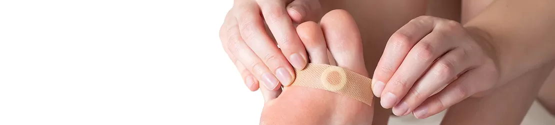 Femeie aplicand plasture medical pe talpa pentru tratarea unor negi plantari.