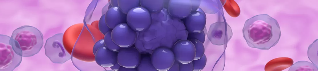 Ilustratie detaliata cu limfom difuz cu celule B mari vazut la microscop