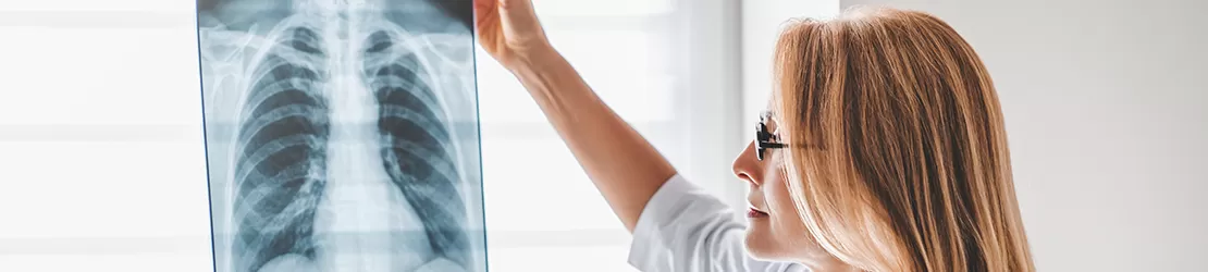Medic analizeaza o radiografie pulmonara pentru evaluarea sanatatii