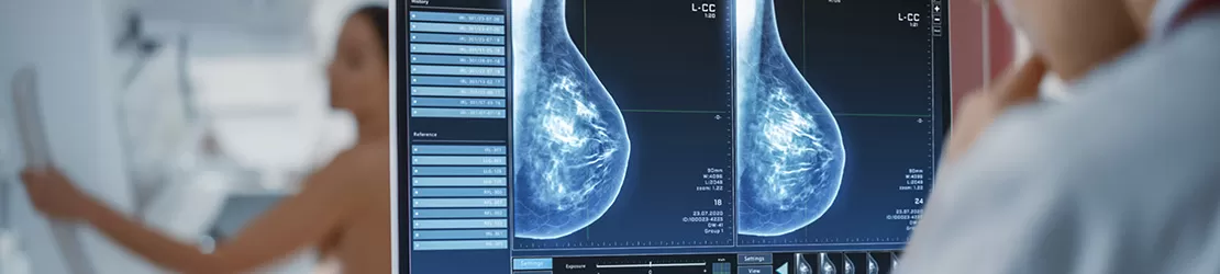 Mamografie - investigatie pentru diagnosticarea cancerului mamar