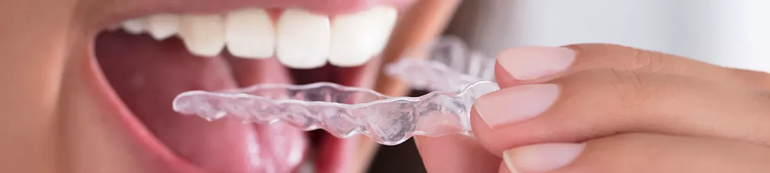 femeie folosind gutiera pentru a minimiza efectele bruxismului