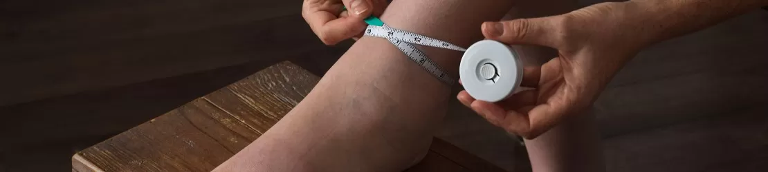 femeie cu limfedem care isi masoara piciorul