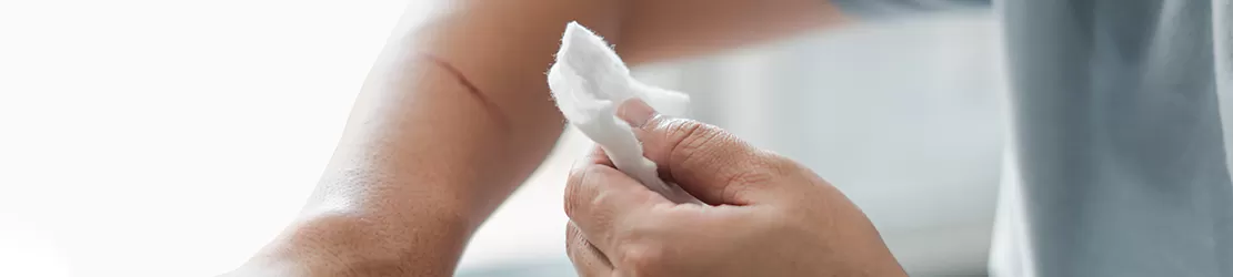 barbat care ingrijeste o rana pentru a evita tetanosul