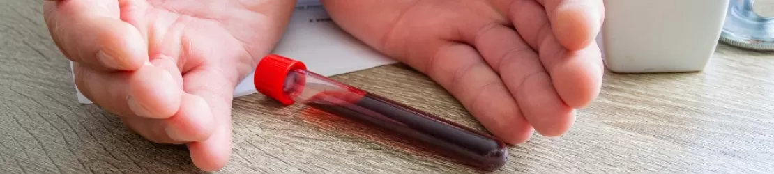 eprubeta cu proba de sange pentru hemofilie