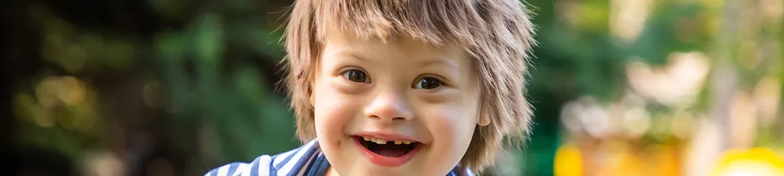 baietel cu sindromul down