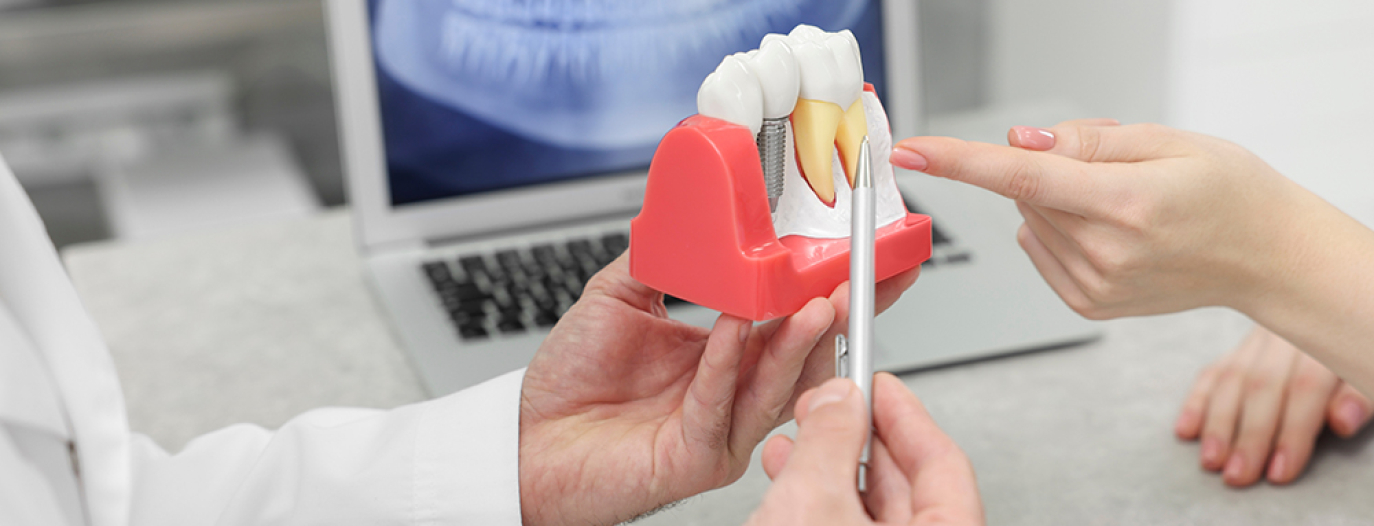 Medic aratandu-i unui pacient un model cu implant dentar.