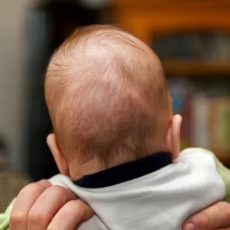 forma capului la bebelusi la ce anomalii trebuie sa fii atent