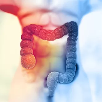 Chirurgia oncologica colorectala