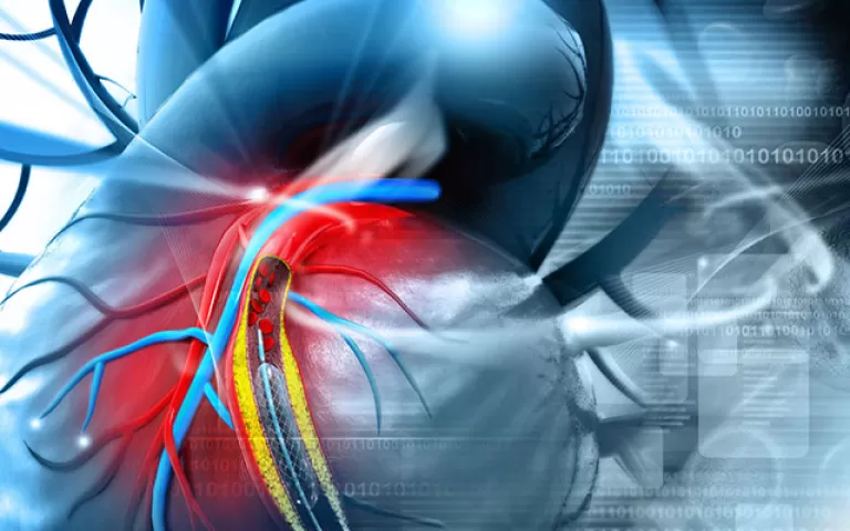 Spitalul MedLife AngioLife