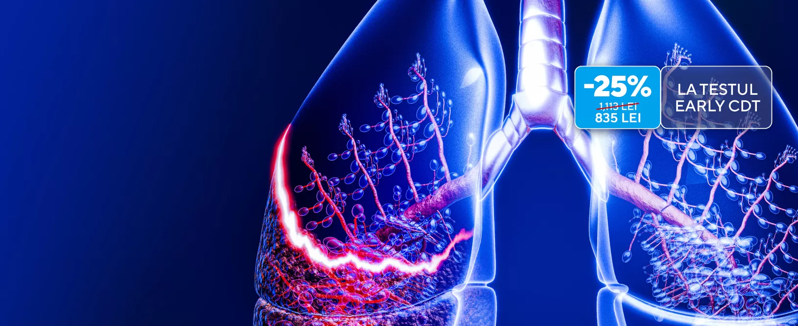 25% reducere la testul Early CDT