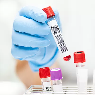 eprubete cu probe de sange pentru analizele uzuale